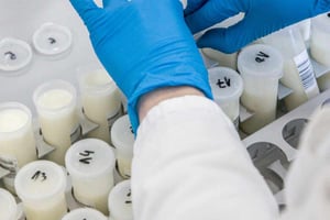 Milk samples